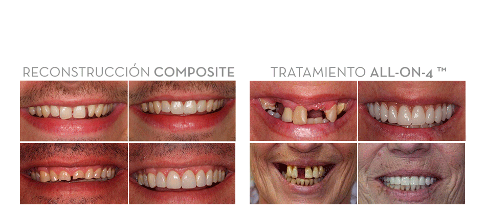 ortodoncia invisible malaga