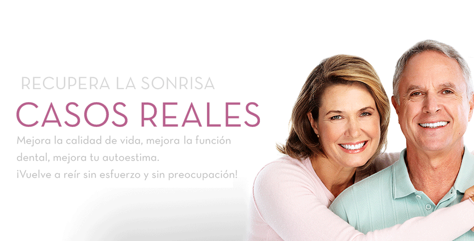 implantes fijos malaga